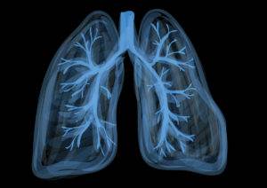 lungs pneumonia
