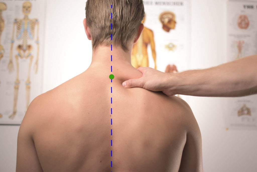 how-to-treat-a-herniated-disc-with-acupuncture-tcm-art-of-wellness