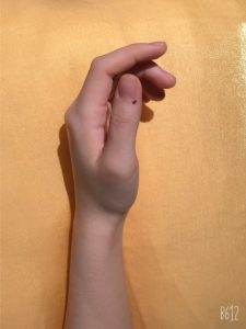 acupressure point for lungs