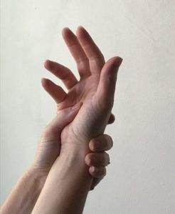 carpal tunnel syndrome