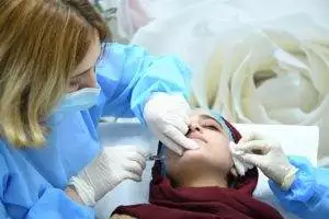 botox treatment