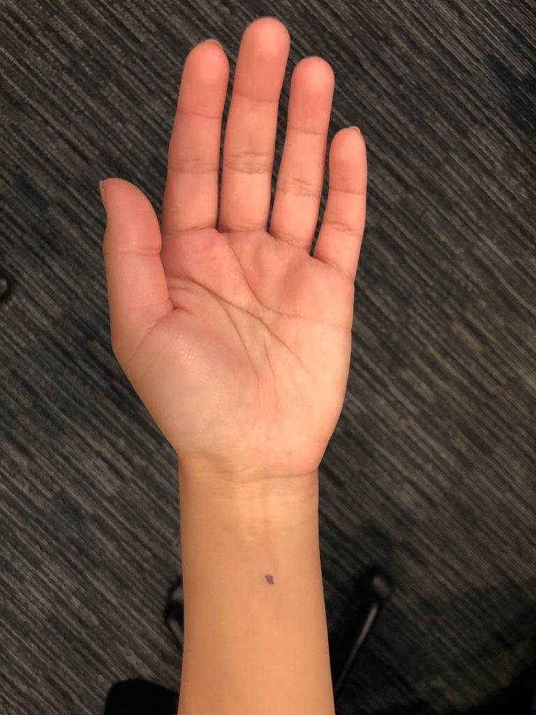 How to Treat Morning Sickness With Acupuncture and TCM » Art of