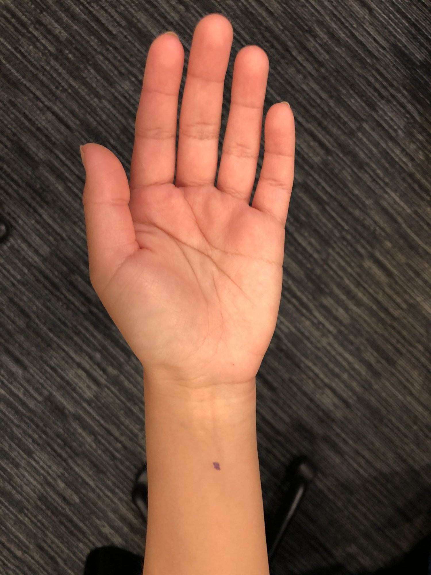 How to Treat Morning Sickness With Acupuncture and TCM » Art of