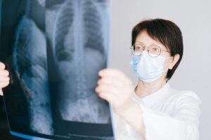 pneumonia lungs x-ray