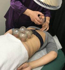 cupping treatment lungs cystic fibrosis