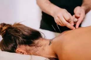 acupuncture pain management