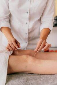 acupuncture for Baker's cyst knee