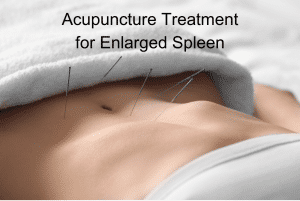 acupuncture for enlarged spleen