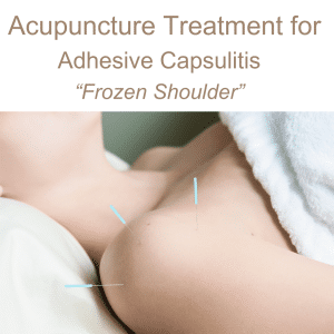 Acupuncture treatment for frozen shoulder